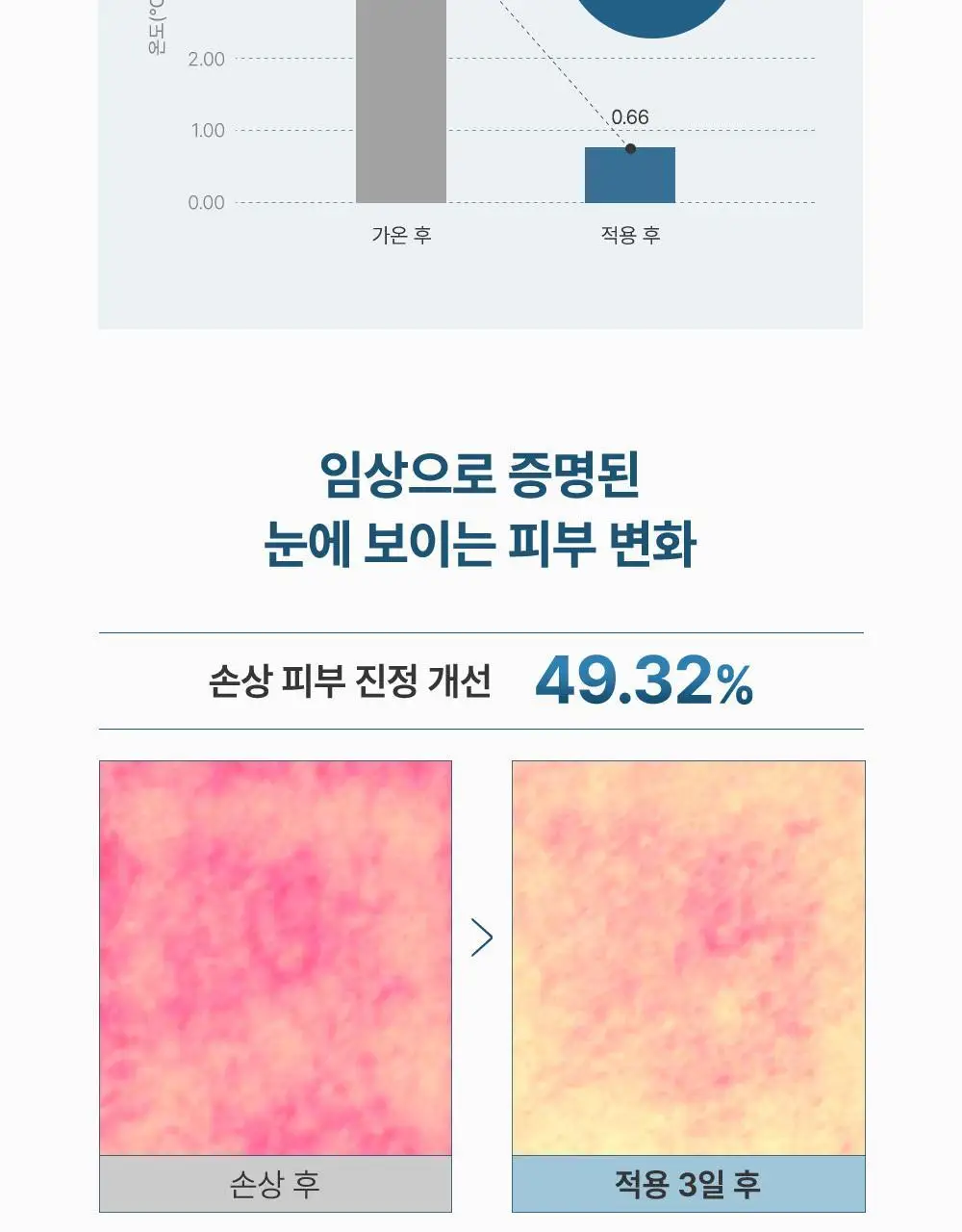 [1등 초밀착 겔/단독기획] 러븀 겔 마스크 4매 (어린시카/PDRN/그린시트러스/유자) 상세페이지 33